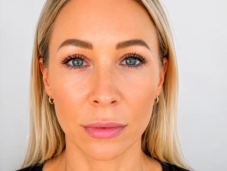 Pigmentation, after treatment