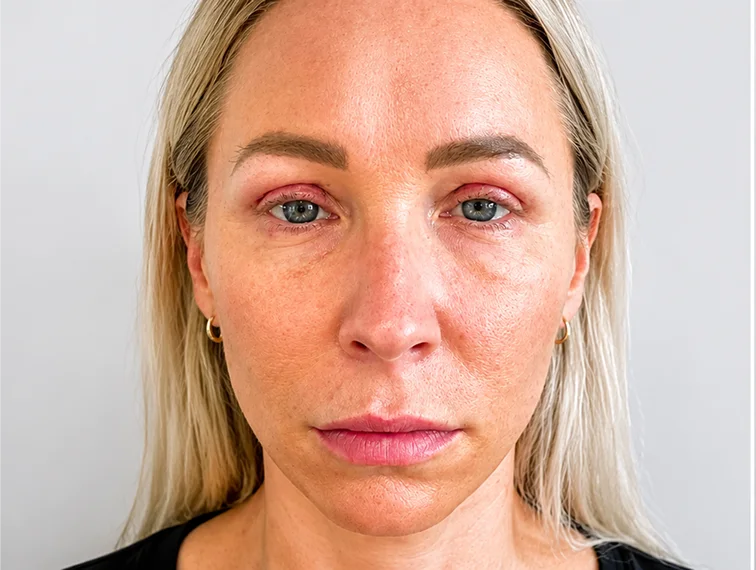 Pigmentation, before treatment