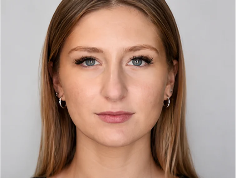 Redness, after treatment